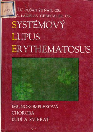 Systémový lupus Erythematosus od Dušan Žitňan